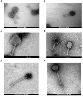 Impact of a phage cocktail targeting Escherichia coli and Enterococcus faecalis as members of a gut bacterial consortium in vitro and in vivo